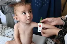 Free Surgical Care Provided to Afghan Children with Heart Conditions
