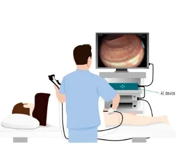 Could AI-Assisted Colonoscopies Diminish Doctors' Skills?