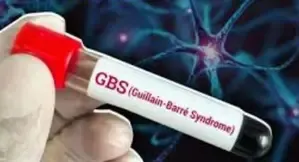 First Fatality from GBS in Mumbai