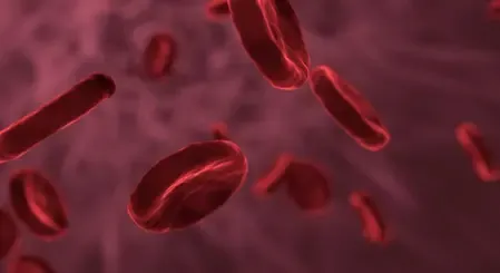 जानें क्या है सिकल सेल एनीमिया, कैसे करें बचाव