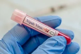 Has a Kerala Woman Tested Positive for Nipah?