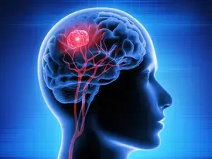 Key Enzyme Identified to Combat Deadly Brain Cancer