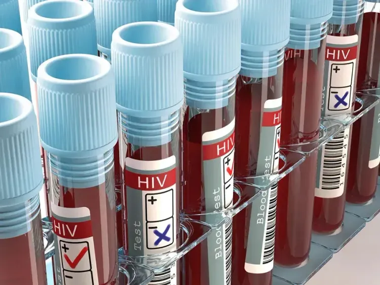 Reduction in Global HIV Funding Could Lead to 10 Million Infections and 3 Million Deaths by 2030: The Lancet