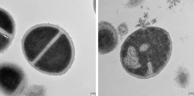 Protein Recycling System in the Human Body Acts as a Defense Against Bacteria: Research