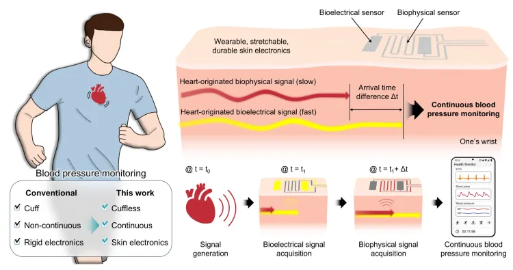 Could a New Bandage-Like Wearable Monitor Revolutionize Continuous BP Measurement?