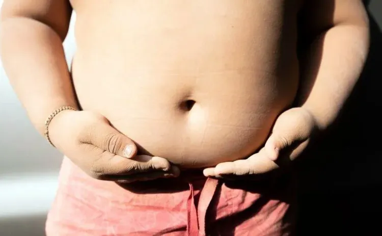 Research Connects Early Antibiotic Use to Obesity in Kids