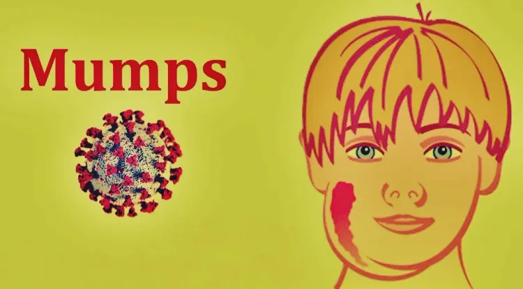 Tamil Nadu Raises Alarm as Mumps Cases Surge Among Schoolchildren in Coimbatore