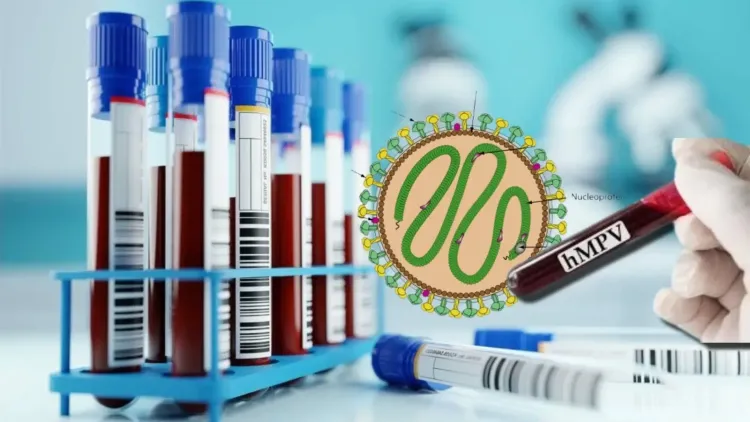 Two Youngsters in Chennai Recover from HMPV Infection