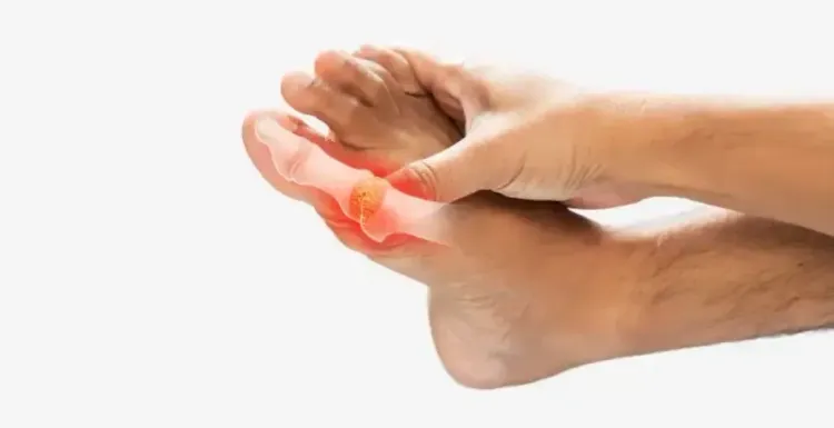 क्या बढ़ा यूरिक एसिड आपके स्वास्थ्य के लिए खतरा है?