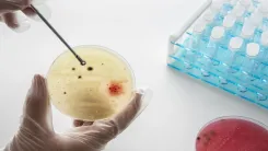 Are Airborne Pathogens More Common in High-Population Areas?