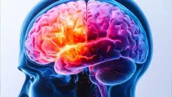 Autistic patients at high risk of Parkinson's disease: Study 