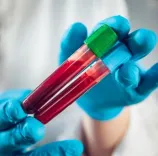 Can a Simple Blood Test Detect Deadly Leukemia Early?