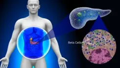 Could Collagen Be Worsening Diabetes?