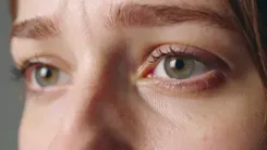 Low-cost HIV drug to improve vision in patients with common diabetes complication