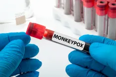 Did mpox Virus Circulate in West Africa Before 2022?