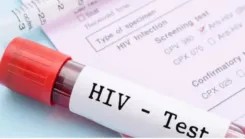 What Does Singapore's 151 New HIV Cases in 2024 Reveal About Late Diagnoses?