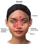 Is Surgery More Effective in Treating Chronic Sinusitis Than Antibiotics?